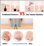 Máquina de Succión Facial — Elimina Puntos Negros