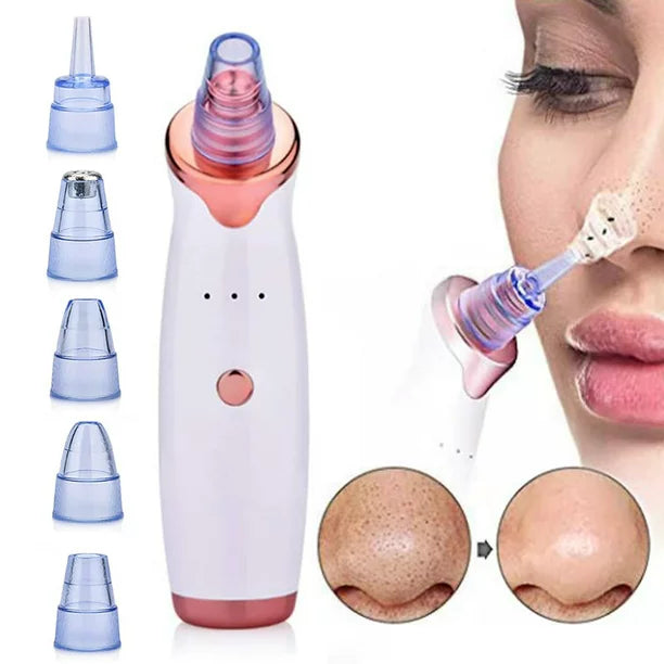 Máquina de Succión Facial — Elimina Puntos Negros